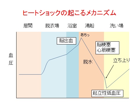 ヒートショックが起きるメカニズム