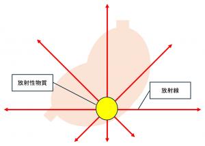 胃